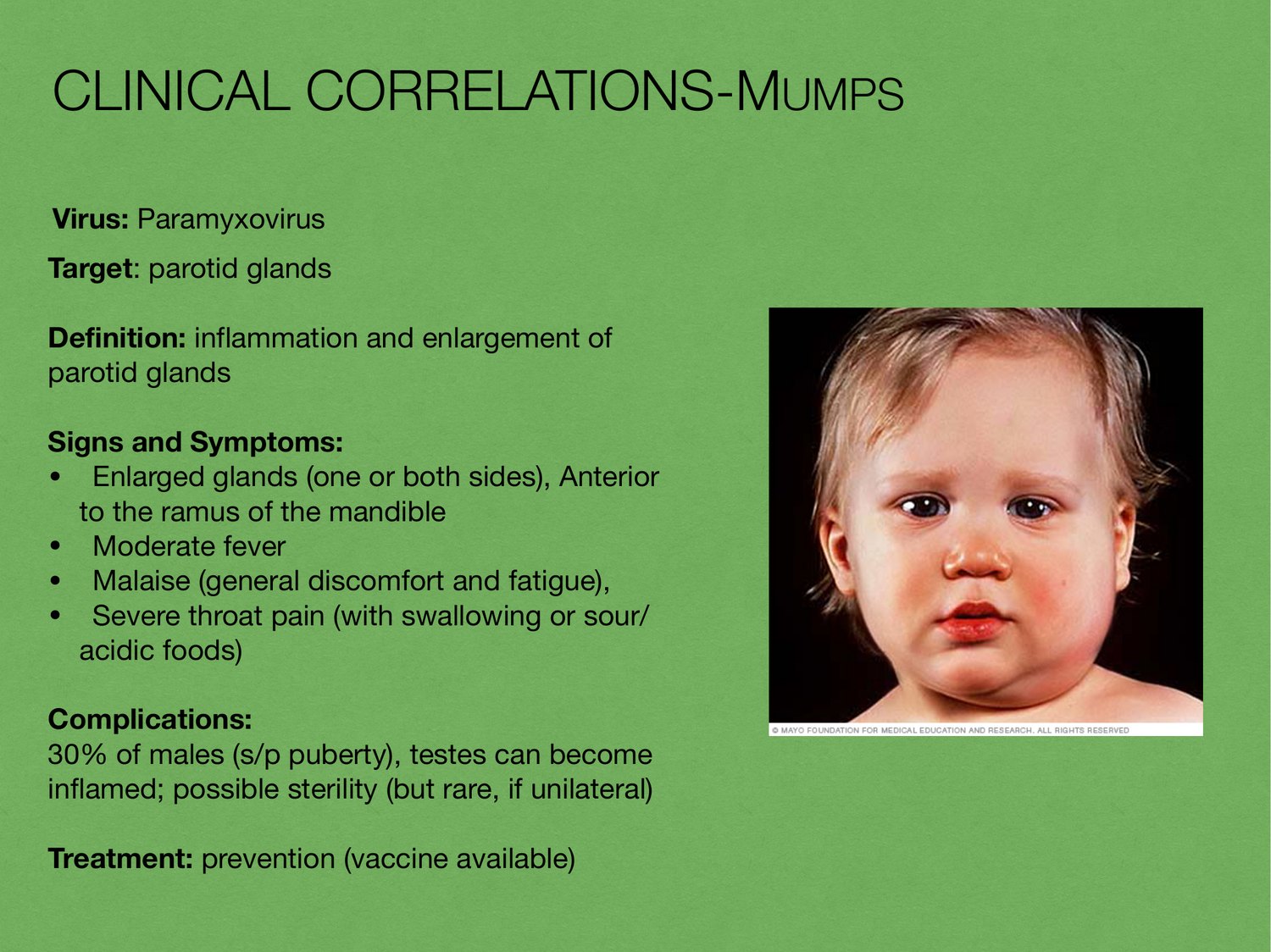 Slide 43 of 97: Clinical correlations-mumps. Dr. Rennie digestive anatomy lecture slide.