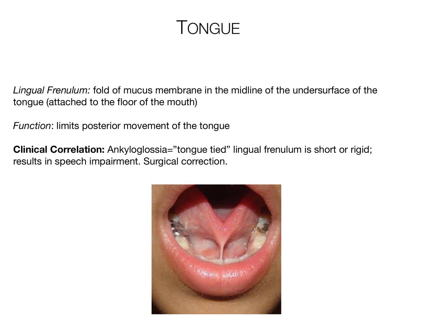 Slide 47 of 97: Tongue. Dr. Rennie digestive anatomy lecture slide.