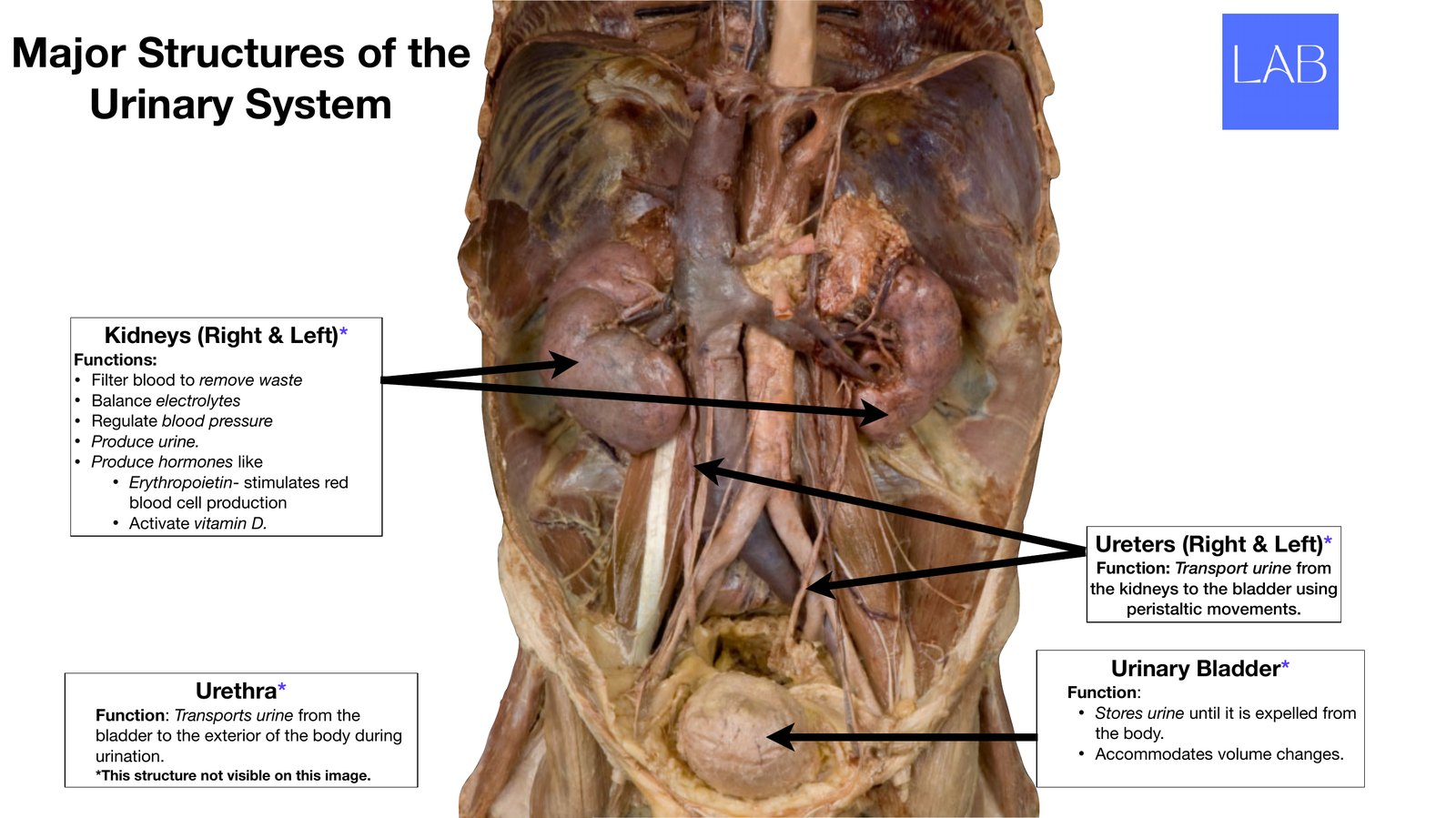 Slide 1 of 28: Major structures of the renal system. Dr. Rennie renal anatomy lecture slide.