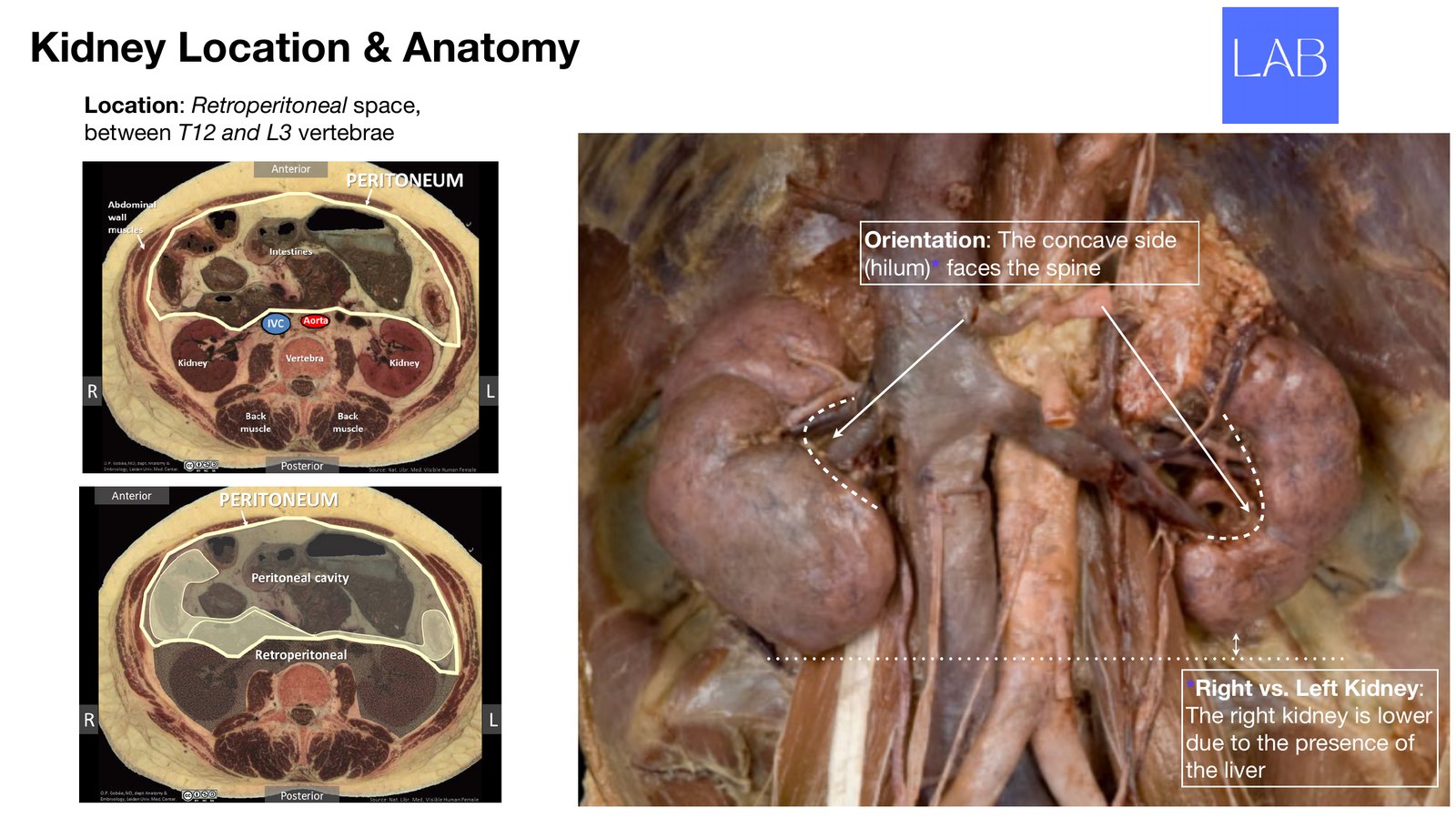 Slide 2 of 28: Kidney location and anatomy. Dr. Rennie renal anatomy lecture slide.
