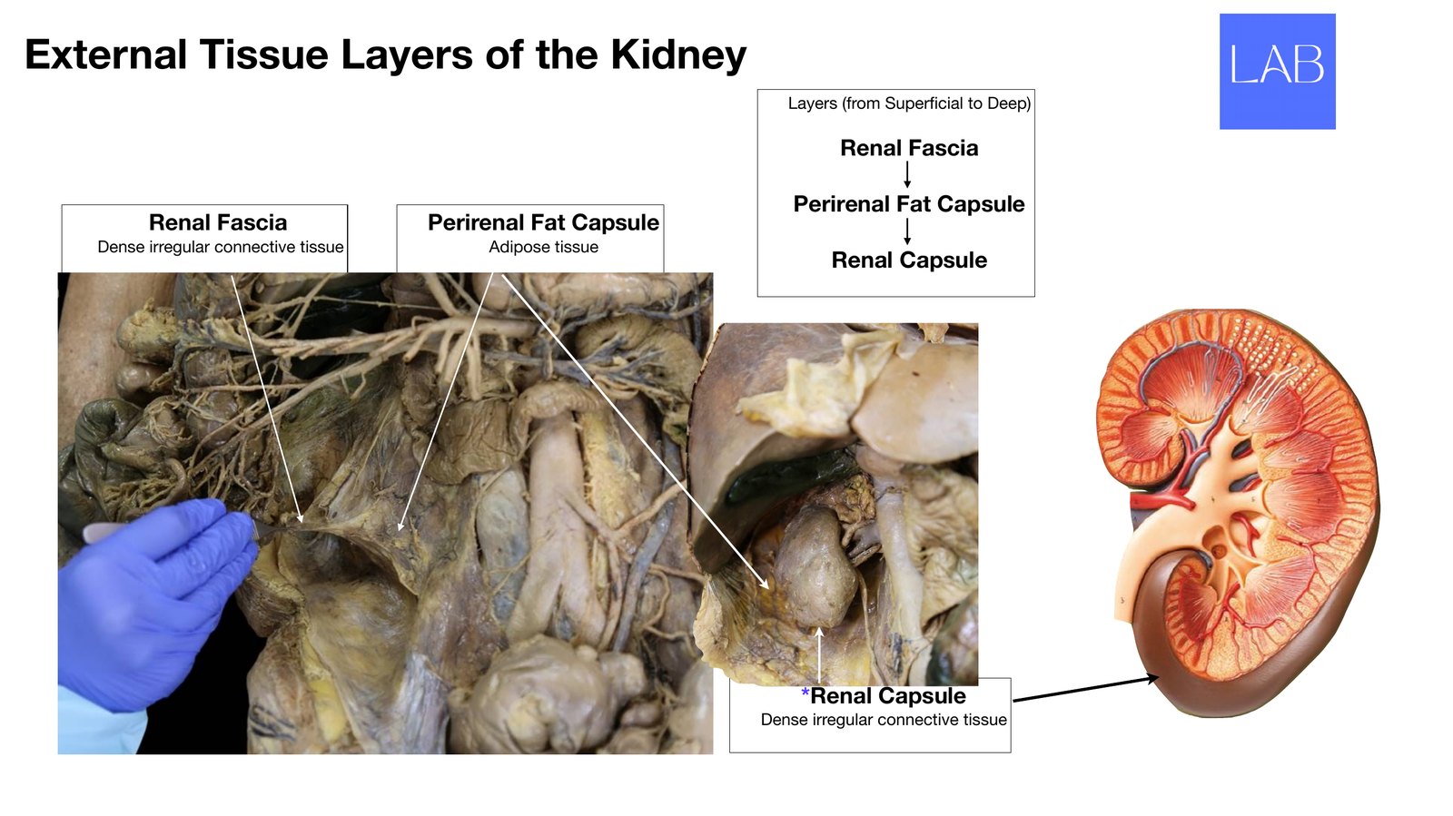Slide 3 of 28: External tissue layers of the kidney. Dr. Rennie renal anatomy lecture slide.